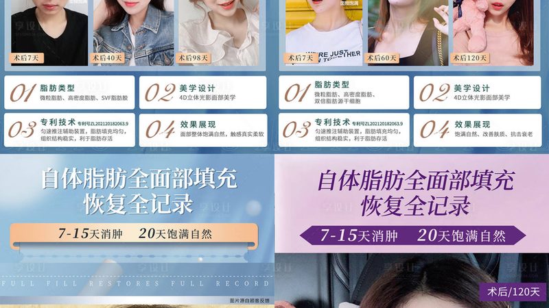 二十多岁的脸，热玛吉是刚需还是智商税