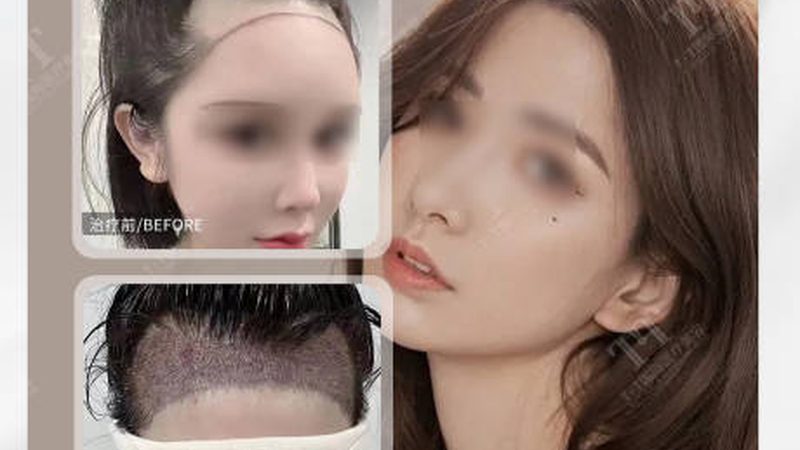 无锡青少年牙齿矫正，如何选择专业机构？**
