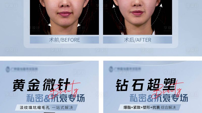 激光祛斑与皮秒激光：价格与技术的深度对比