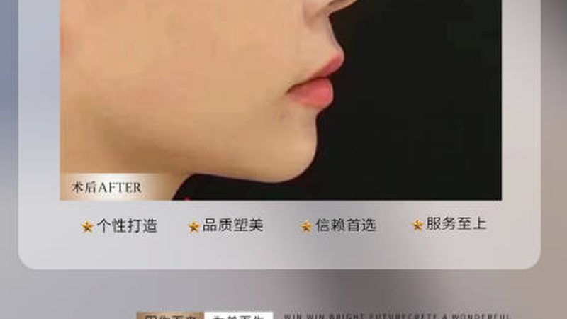 瘦脸贴片材质揭秘：如何挑选最适合你的产品**
