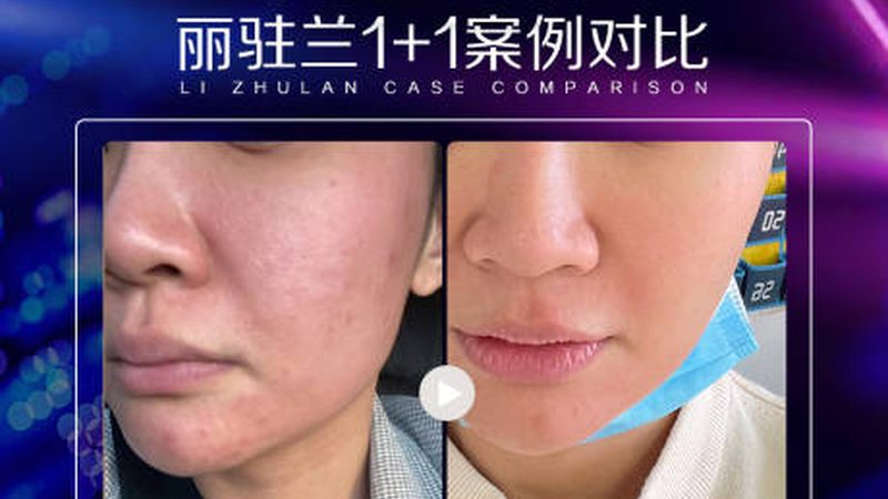 消费者疑虑：隐形消费的真面目