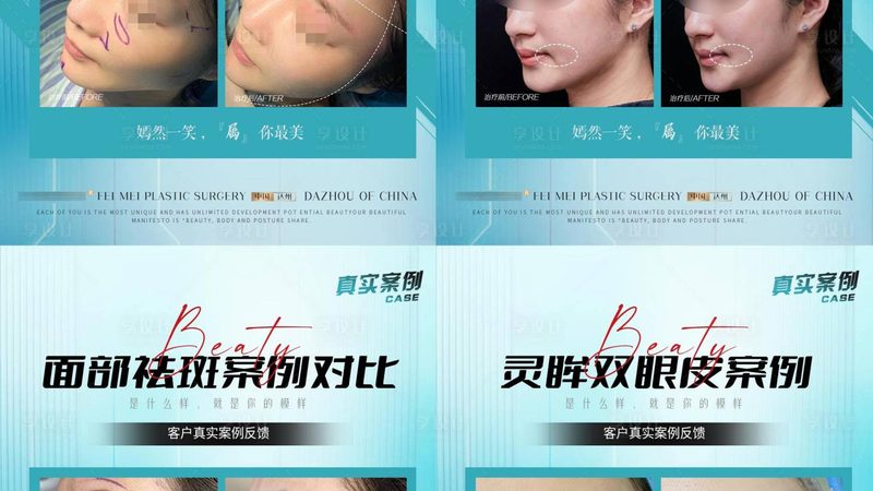 肉毒素面部提升：揭秘前后对比图背后的秘密