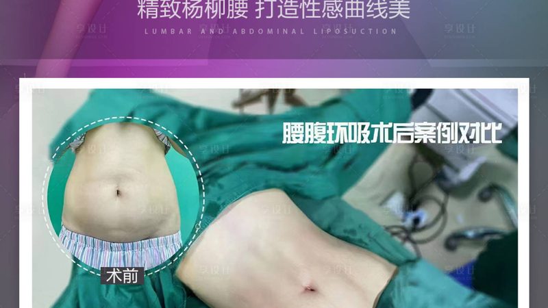 揭秘医美产品批发代理加盟：费用构成与避坑指南