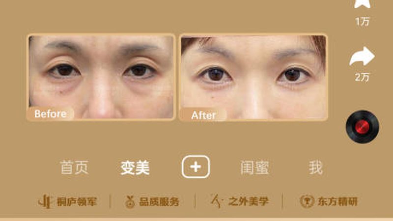 小标题：了解肉毒素注射原理