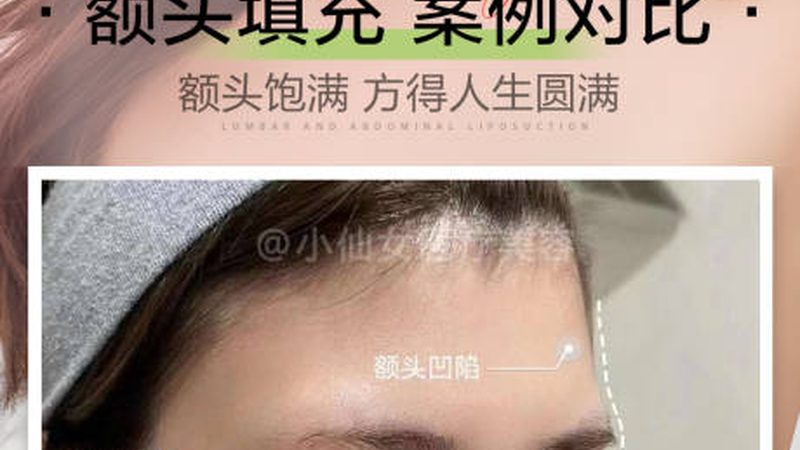超声炮术后护理，这几点不能忽视**