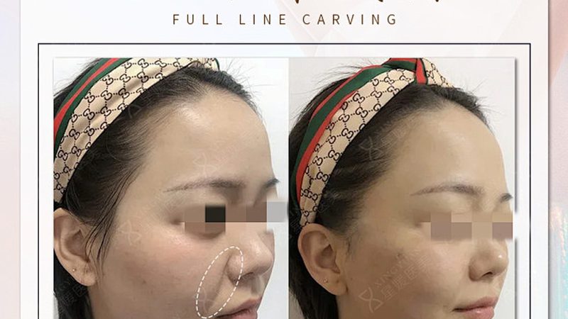 医美与生美：揭秘两者的本质区别