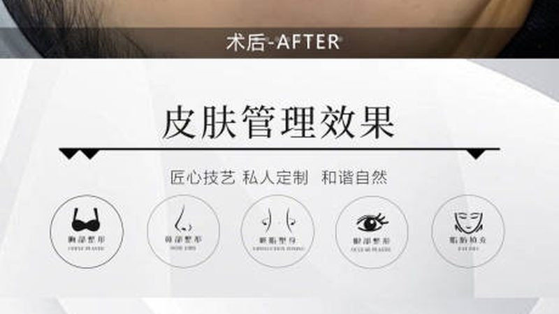 瘦脸面膜与瘦脸仪对比测评