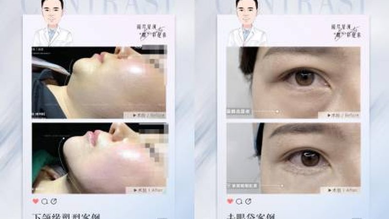 瘦脸操：短期效果，长期坚持