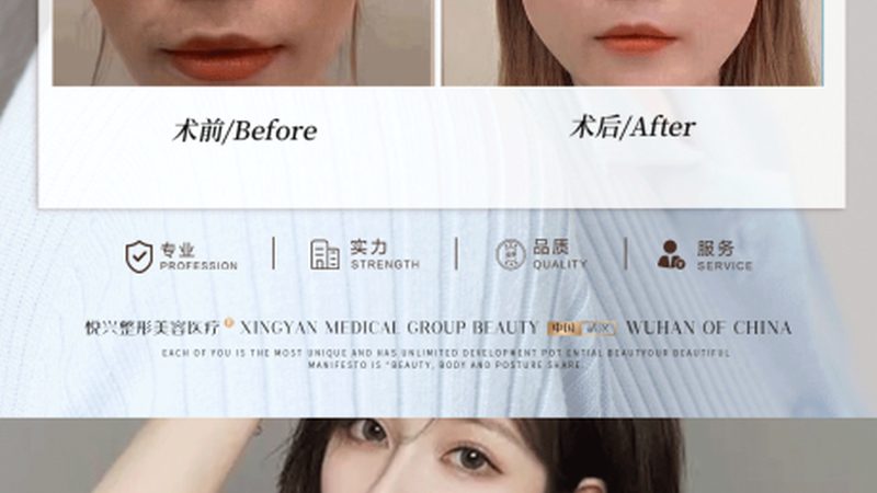 小标题：了解修复原因，明确手术目的