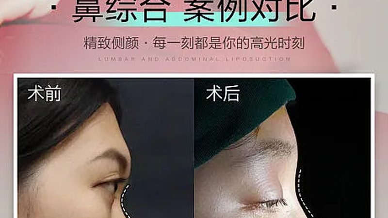 注射美容加盟代理：费用构成与合理考量**
