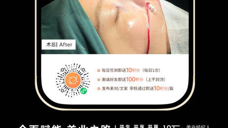 超声炮全身治疗：揭秘价格背后的秘密